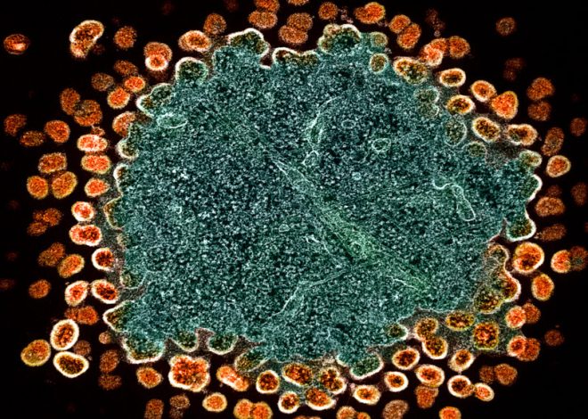 ViiV expands licensing deal for its HIV drug in low-income countries