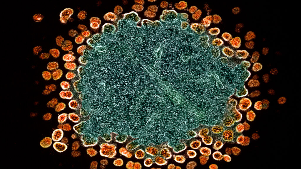 ViiV expands licensing deal for its HIV drug in low-income countries