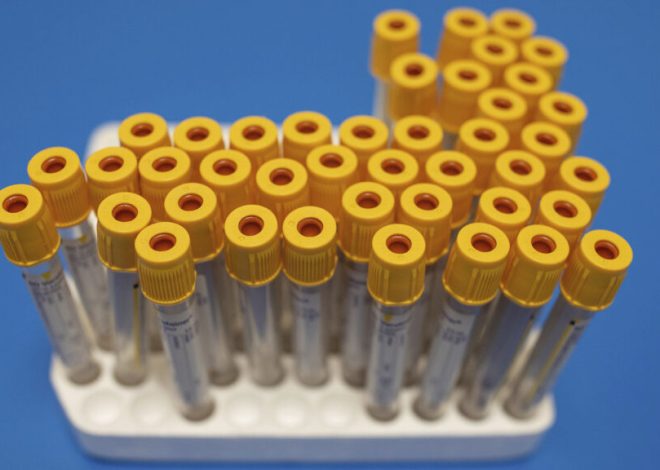 Exact Sciences acquires Freenome colon cancer liquid biopsy