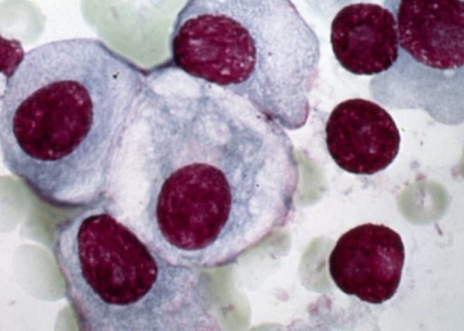 Gilead, Arcellx multiple myeloma drug anito-cel reports strong data