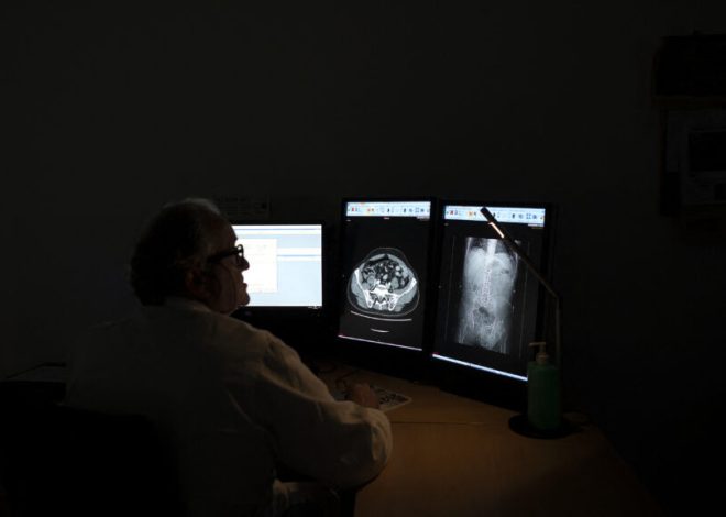 In radiology, AI is advancing faster than the field can keep up