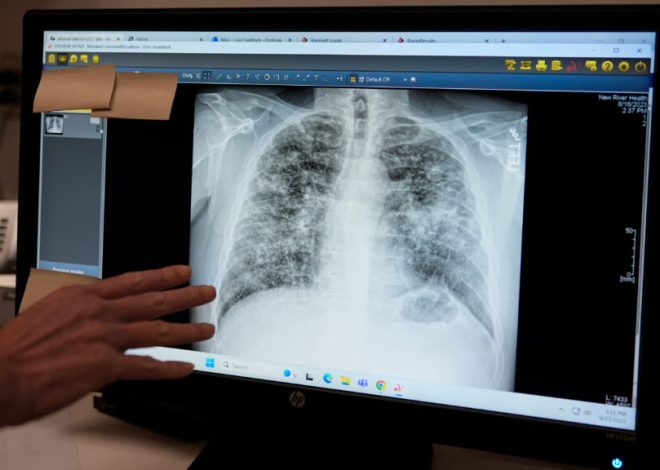 FDA gives generative AI in radiology two breakthrough designation nods